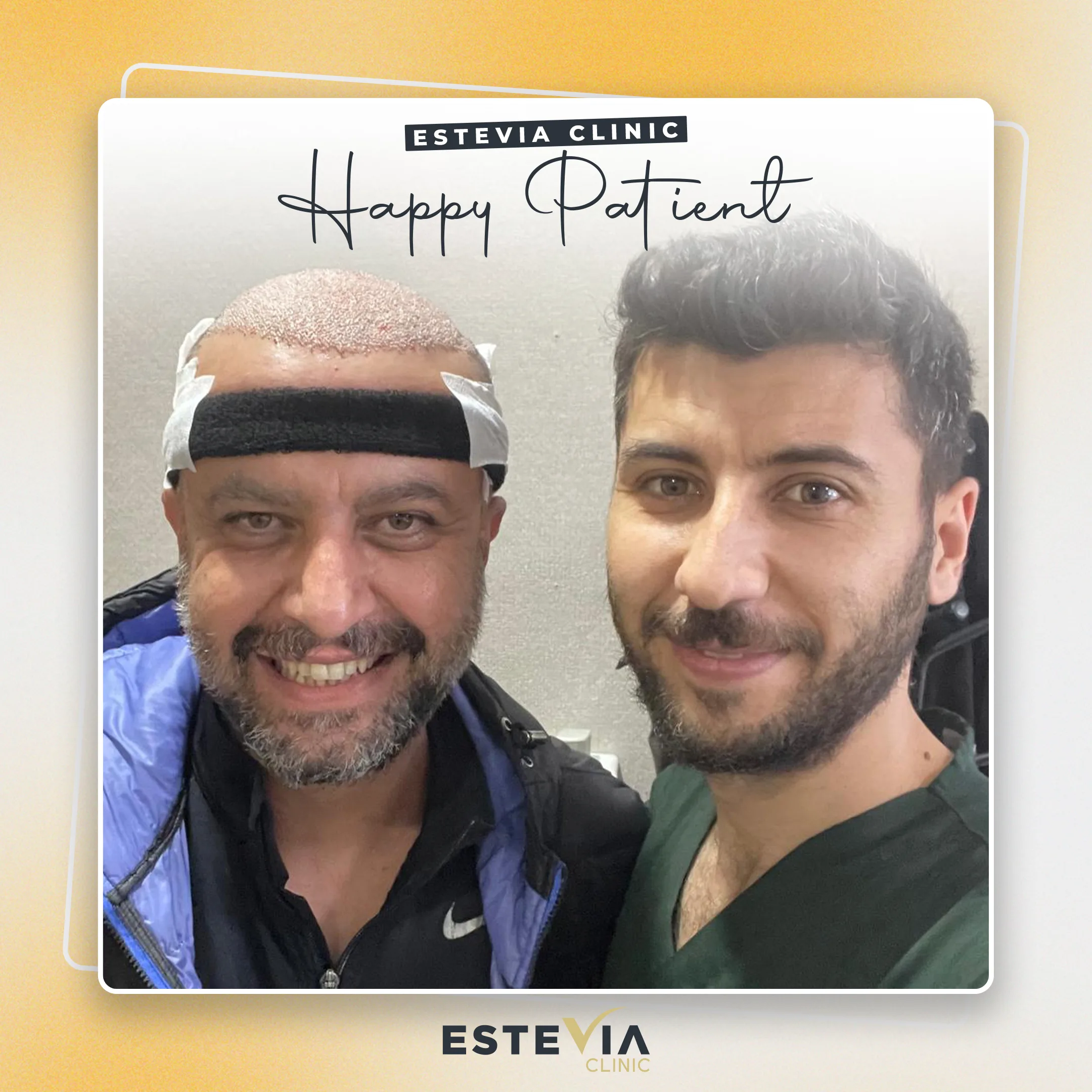 Happy Estevia Clinic hair transplant patient — photo 1