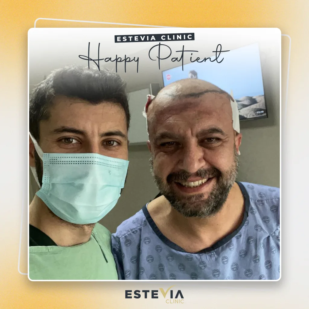 hair-transplant-happy-patient-1.6 Happy Estevia Clinic hair transplant patient — photo 6